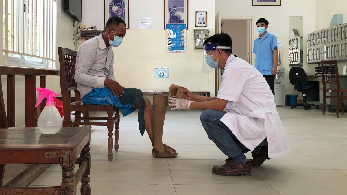 Ky Bou, a prosthetist and orthotist, examines Seng Kosal’s stump and the space inside his prosthesis lining at the Exceed clinic in Phnom Penh’s Stung Meanchey III Commune on 7 June 2021. Quinn Libson