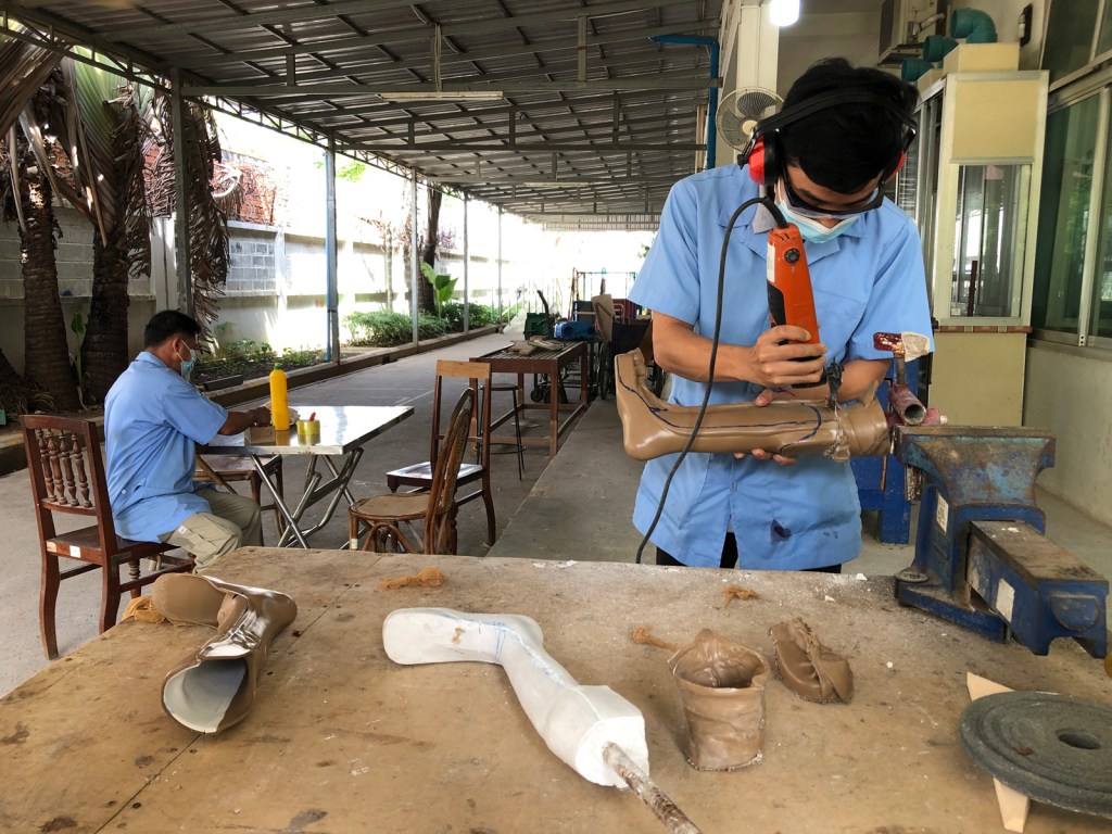 Since the start of the pandemic, Exceed’s staff have been making prosthetic and orthotic devices despite a 50% reduction in employees at the clinic to try to keep technicians, clinicians and clients safe from COVID-19 infection. Quinn Libson